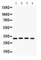 Potassium Voltage-Gated Channel Interacting Protein 2 antibody, PB9652, Boster Biological Technology, Western Blot image 