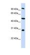 EMAP Like 1 antibody, NBP1-56595, Novus Biologicals, Western Blot image 