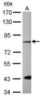 G Protein-Coupled Receptor Kinase 2 antibody, PA5-28579, Invitrogen Antibodies, Western Blot image 