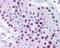 MAGE Family Member A6 antibody, 49-715, ProSci, Immunohistochemistry paraffin image 