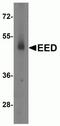 Embryonic Ectoderm Development antibody, NBP2-81819, Novus Biologicals, Western Blot image 