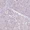 Nuclear VCP Like antibody, PA5-55801, Invitrogen Antibodies, Immunohistochemistry paraffin image 