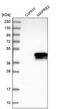 Microtubule Associated Protein RP/EB Family Member 2 antibody, PA5-53483, Invitrogen Antibodies, Western Blot image 