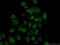 RAD51 Associated Protein 1 antibody, 11255-1-AP, Proteintech Group, Immunofluorescence image 