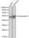 Keratin 8 antibody, GTX32549, GeneTex, Western Blot image 