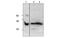 Activin A Receptor Type 1C antibody, MBS837777, MyBioSource, Western Blot image 