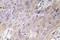 Bone Morphogenetic Protein 3 antibody, LS-C177723, Lifespan Biosciences, Immunohistochemistry paraffin image 