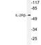 Interleukin 2 Receptor Subunit Beta antibody, LS-C177555, Lifespan Biosciences, Western Blot image 