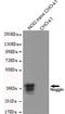 Noggin antibody, STJ99187, St John