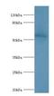 Interferon Alpha And Beta Receptor Subunit 2 antibody, LS-C375945, Lifespan Biosciences, Western Blot image 