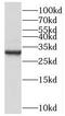 Complement C1q Binding Protein antibody, FNab01073, FineTest, Western Blot image 