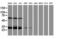 Centromere protein H antibody, M06302-1, Boster Biological Technology, Western Blot image 