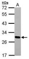 Distal-Less Homeobox 1 antibody, GTX108804, GeneTex, Western Blot image 