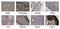 Melanoma Cell Adhesion Molecule antibody, NBP2-48207, Novus Biologicals, Immunohistochemistry paraffin image 