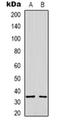 Syntaxin 1A antibody, orb318842, Biorbyt, Western Blot image 