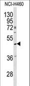 Serpin Family A Member 4 antibody, LS-C100659, Lifespan Biosciences, Western Blot image 