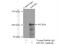 Kinesin Family Member 18A antibody, 19245-1-AP, Proteintech Group, Immunoprecipitation image 