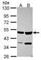 Histone methyltransferase SMYD2 antibody, GTX116510, GeneTex, Western Blot image 