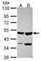 SET And MYND Domain Containing 2 antibody, GTX116510, GeneTex, Western Blot image 