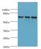 DEAD-Box Helicase 3 X-Linked antibody, LS-C369537, Lifespan Biosciences, Western Blot image 