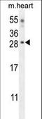 Claudin 6 antibody, LS-C168818, Lifespan Biosciences, Western Blot image 