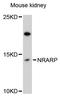 NOTCH Regulated Ankyrin Repeat Protein antibody, LS-C747945, Lifespan Biosciences, Western Blot image 