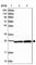 SPC25 Component Of NDC80 Kinetochore Complex antibody, HPA047144, Atlas Antibodies, Western Blot image 