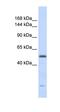 DNA Replication Helicase/Nuclease 2 antibody, orb324652, Biorbyt, Western Blot image 