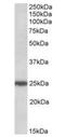 Rho GDP Dissociation Inhibitor Gamma antibody, orb20624, Biorbyt, Western Blot image 