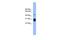 Proteasome 26S Subunit, Non-ATPase 9 antibody, PA5-44971, Invitrogen Antibodies, Western Blot image 