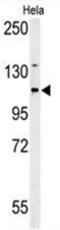 Adenylate Cyclase 4 antibody, AP50087PU-N, Origene, Western Blot image 