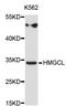 3-Hydroxy-3-Methylglutaryl-CoA Lyase antibody, STJ24045, St John