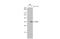 Enterovirus antibody, GTX633390, GeneTex, Western Blot image 