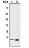 Prefoldin Subunit 1 antibody, GTX56235, GeneTex, Western Blot image 