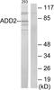 Adducin 2 antibody, LS-C119380, Lifespan Biosciences, Western Blot image 