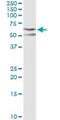 C-Terminal Src Kinase antibody, H00001445-M01, Novus Biologicals, Immunoprecipitation image 