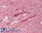 TANK Binding Kinase 1 antibody, LS-B12439, Lifespan Biosciences, Immunohistochemistry paraffin image 