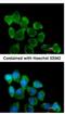 Involucrin antibody, NBP2-16981, Novus Biologicals, Immunocytochemistry image 