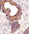 Proprotein Convertase Subtilisin/Kexin Type 9 antibody, 62-831, ProSci, Immunohistochemistry paraffin image 