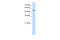 Serine Hydroxymethyltransferase 2 antibody, 30-163, ProSci, Western Blot image 