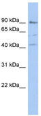 Poly(ADP-Ribose) Polymerase Family Member 12 antibody, TA334714, Origene, Western Blot image 