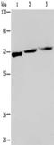 Kelch Like Family Member 1 antibody, TA350118, Origene, Western Blot image 