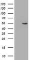 ALG2 Alpha-1,3/1,6-Mannosyltransferase antibody, MA5-25852, Invitrogen Antibodies, Western Blot image 
