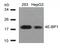 Eukaryotic Translation Initiation Factor 4E Binding Protein 1 antibody, GTX50543, GeneTex, Western Blot image 