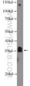 Msh Homeobox 1 antibody, 17678-1-AP, Proteintech Group, Western Blot image 