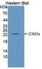 Interleukin 1 Alpha antibody, LS-C373889, Lifespan Biosciences, Western Blot image 