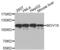 Mov10 RISC Complex RNA Helicase antibody, abx002903, Abbexa, Western Blot image 