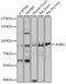 Axin 2 antibody, GTX30080, GeneTex, Western Blot image 