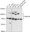 RNA Binding Motif Protein 15B antibody, 23-951, ProSci, Western Blot image 