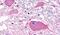 Brain-specific angiogenesis inhibitor 3 antibody, PA5-33357, Invitrogen Antibodies, Immunohistochemistry frozen image 